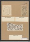 Campylodiscus latus Shadb. (de-Toni-Nr.: Genus 57, Species 2460) Zeichnungen Sammlung Grunow Nr. 4956 (NHMW-BOT-W0373177)